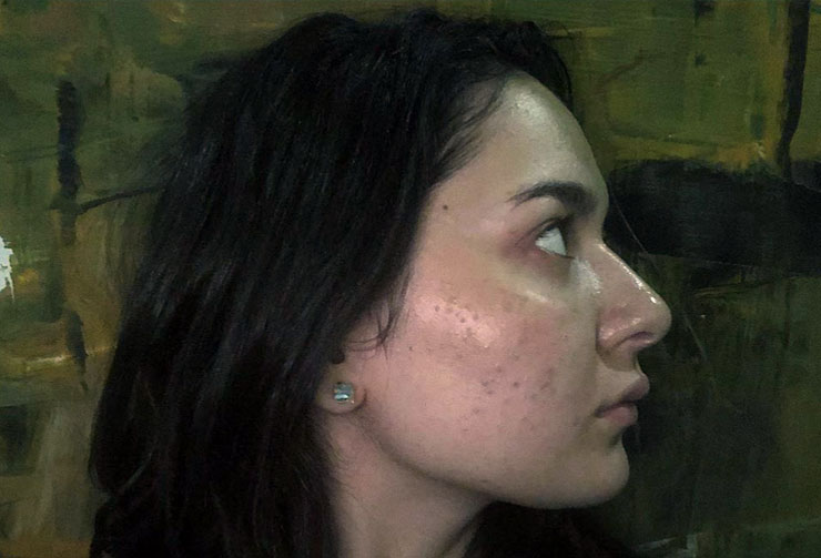 Hania-Amir-Acne-Photo-and-Yasir-Hussain-Joke